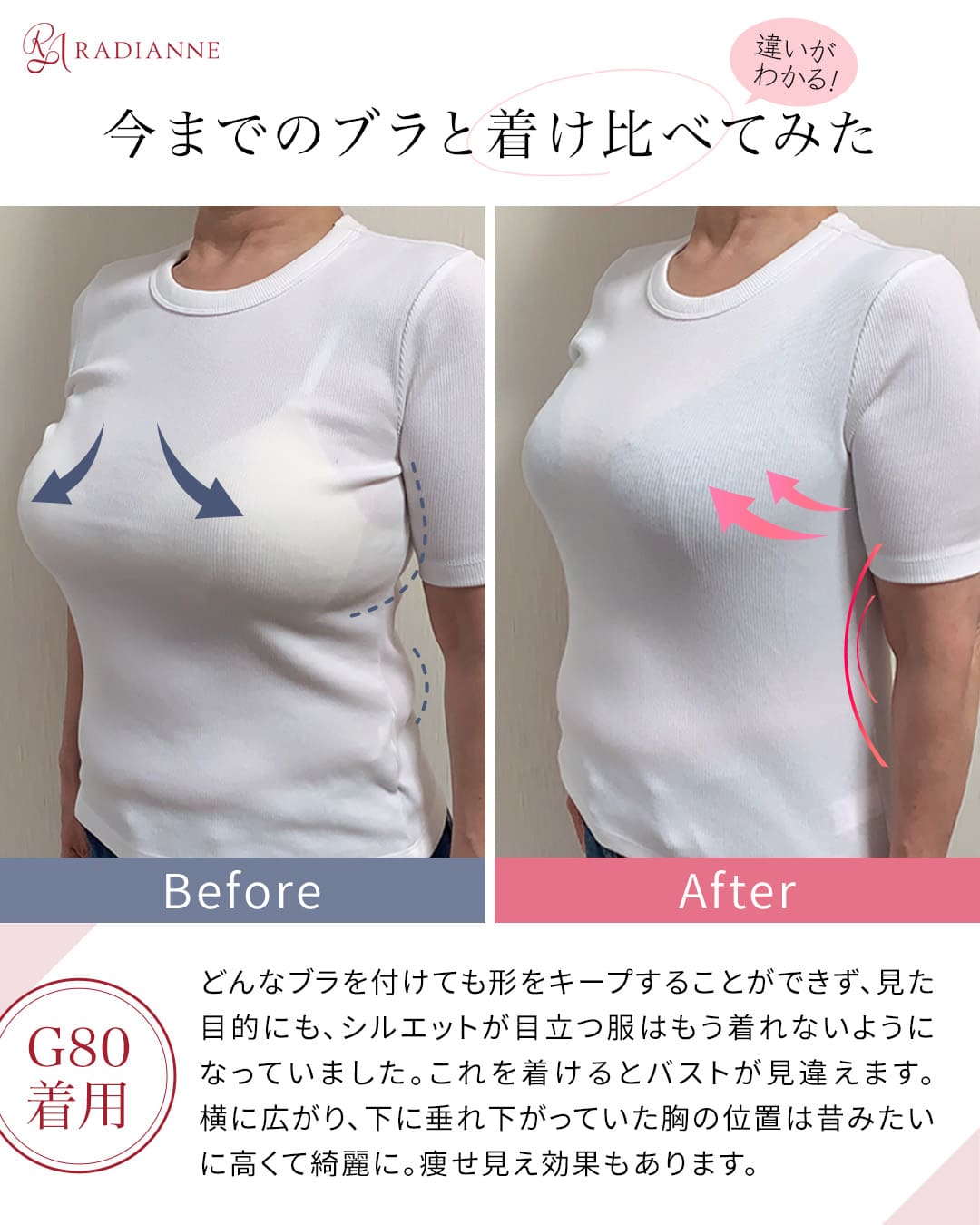 コネクトバストブラ ドラマティックレース