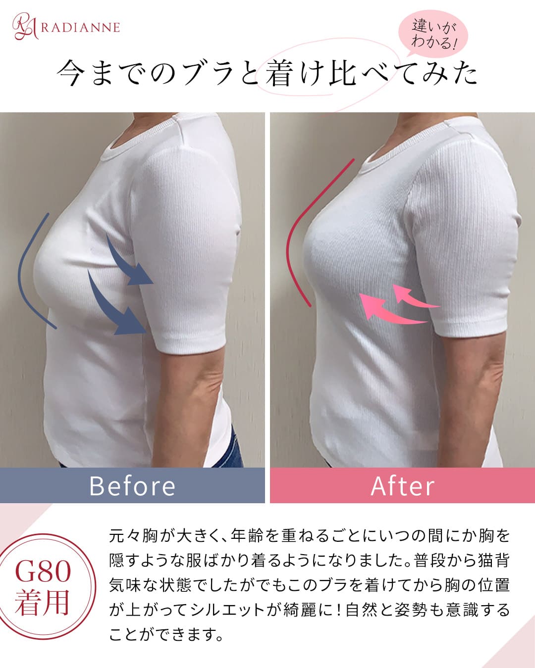 コネクトバストブラ ドラマティックレース